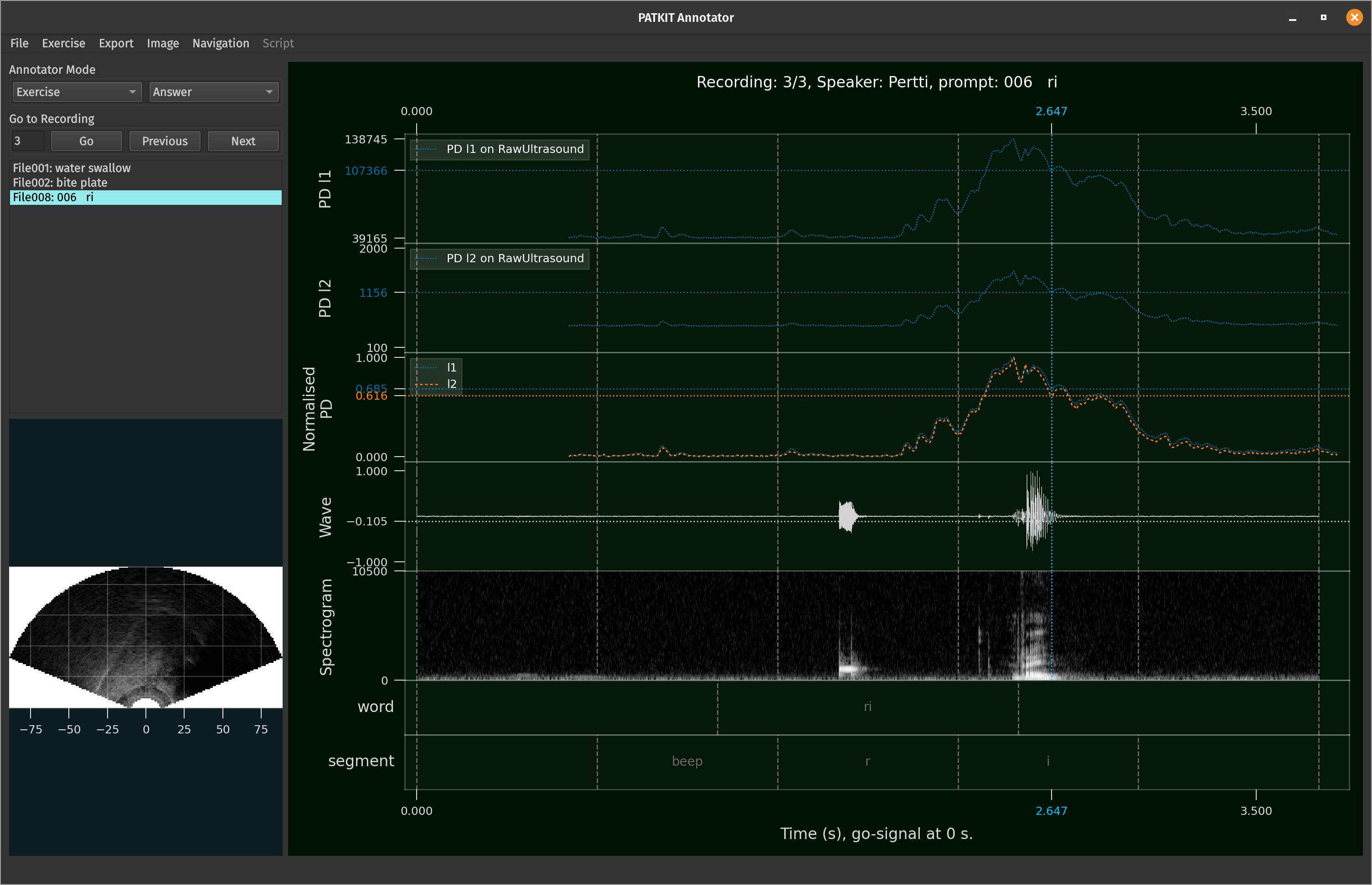 PATKIT GUI 0.20.1 in exercise mode