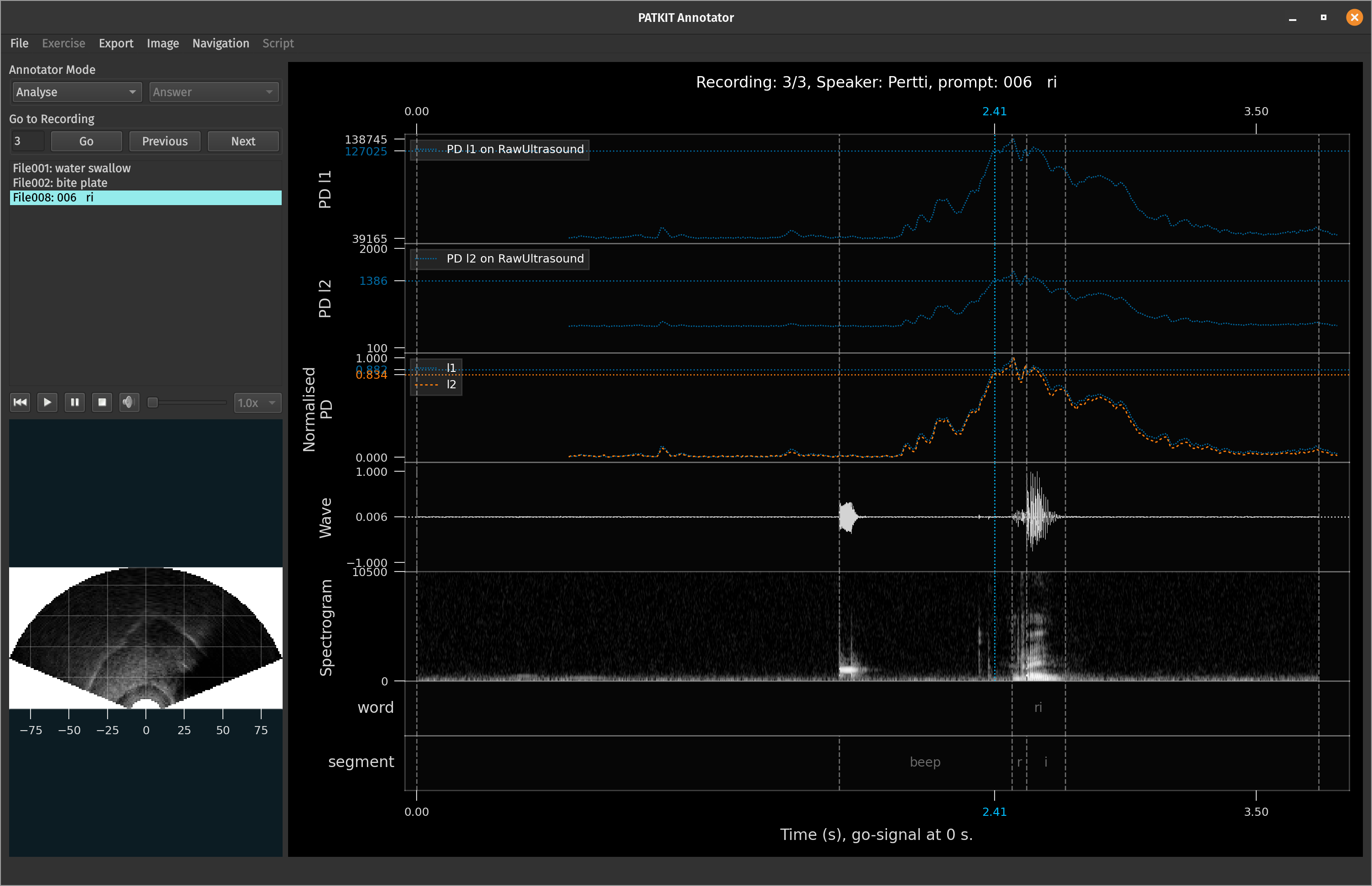 PATKIT GUI 0.21.0 in dark mode