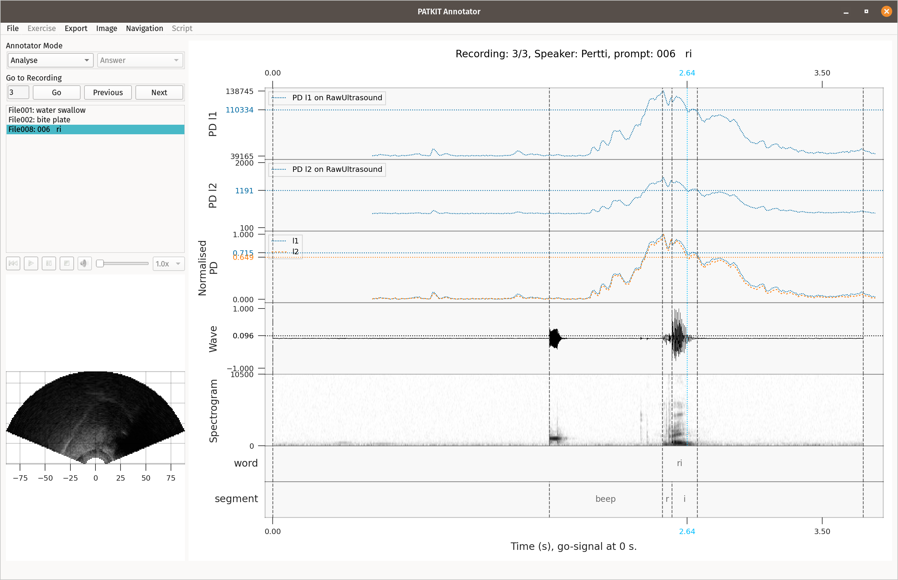 PATKIT GUI 0.22.0 in light mode