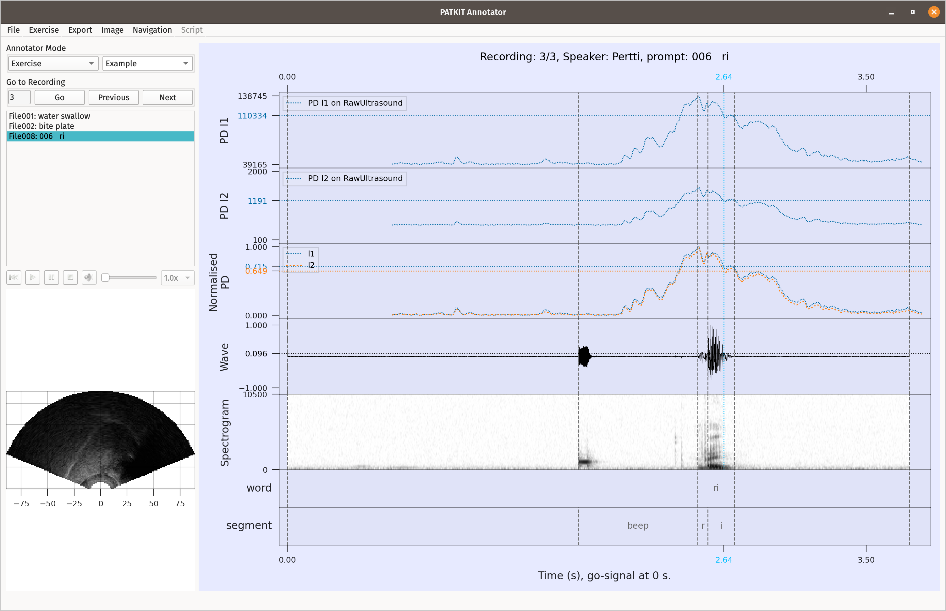 PATKIT GUI 0.22.0 in light example mode