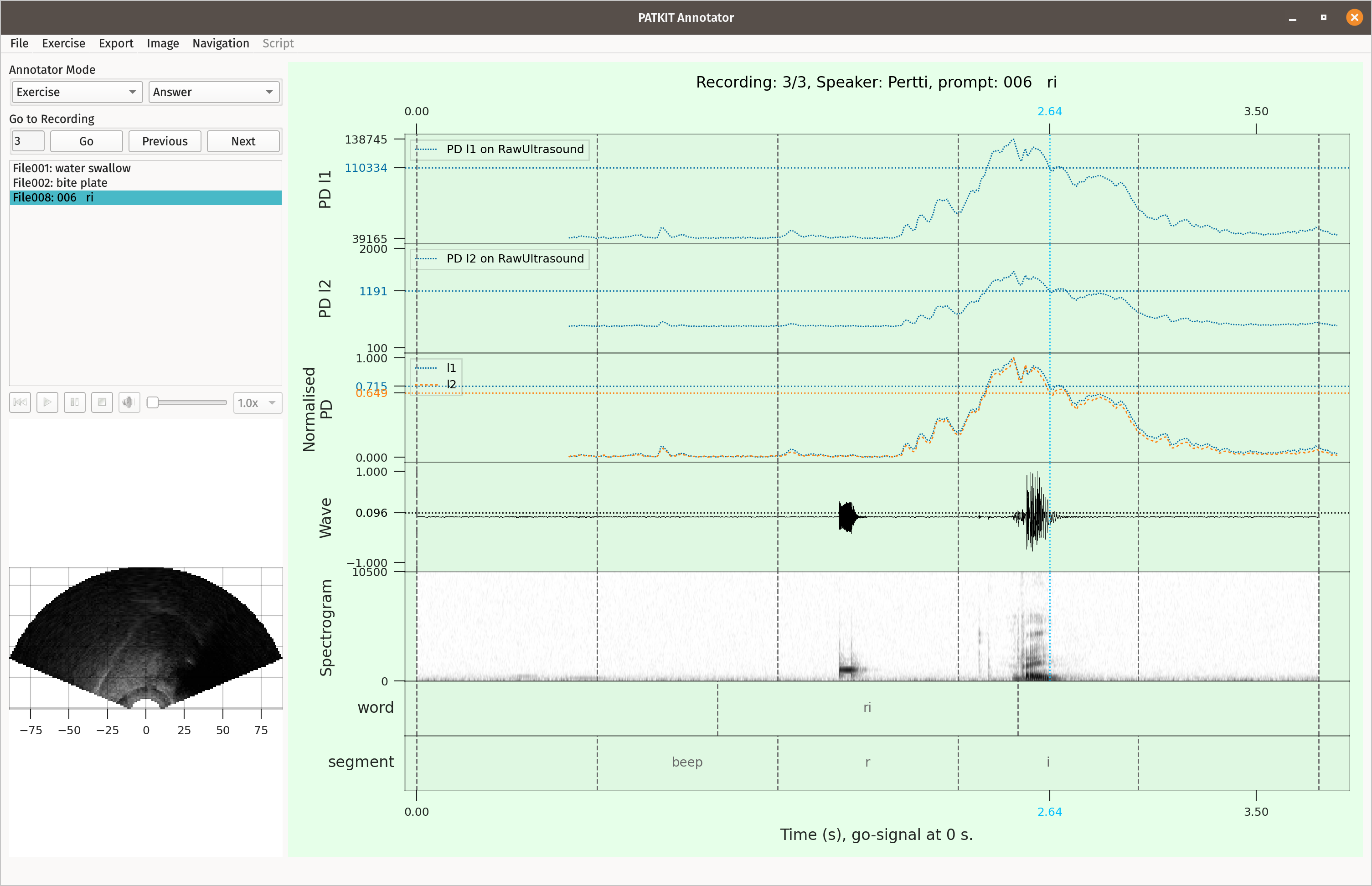 PATKIT GUI 0.22.0 in light exercise mode